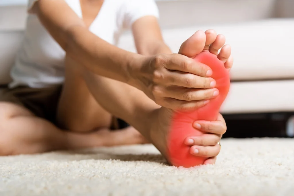 The heel and arch where plantar fasciitis pain concentrates, highlighted
