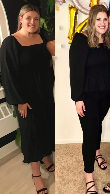 Before and after photographs of a weight loss program patient