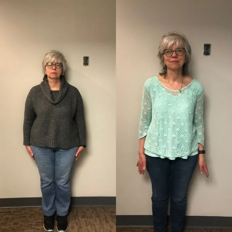 Before and after photographs of a weight loss program patient