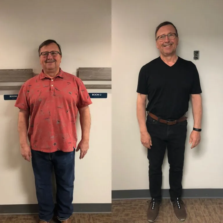 Before and after photographs of a weight loss program patient