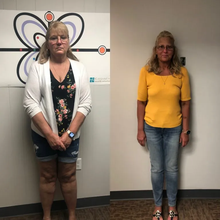 Before and after photographs of a weight loss program patient