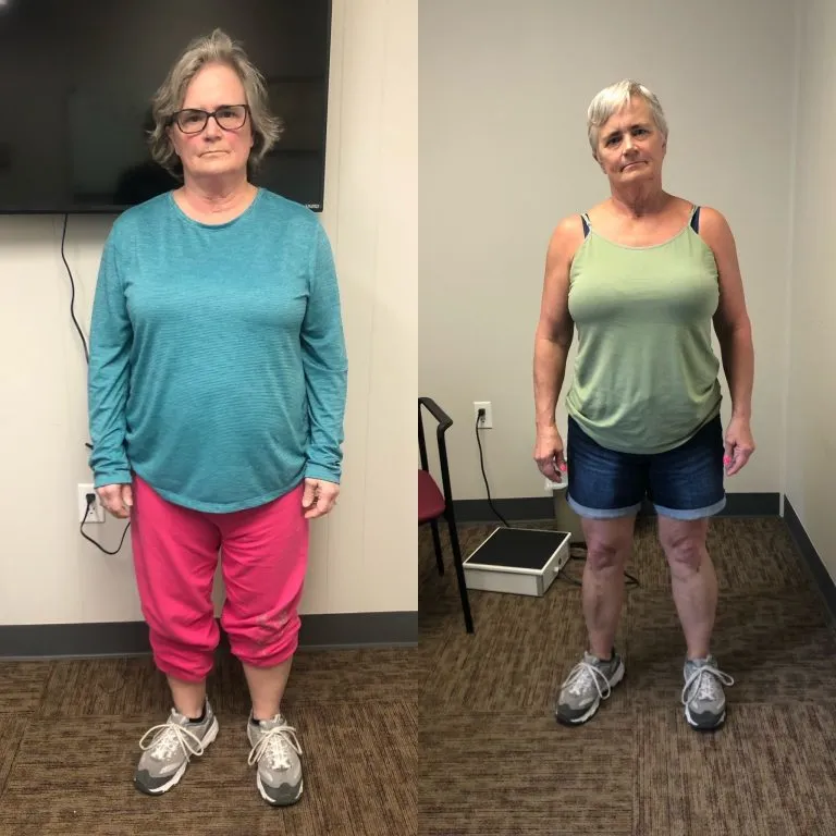 Before and after photographs of a weight loss program patient