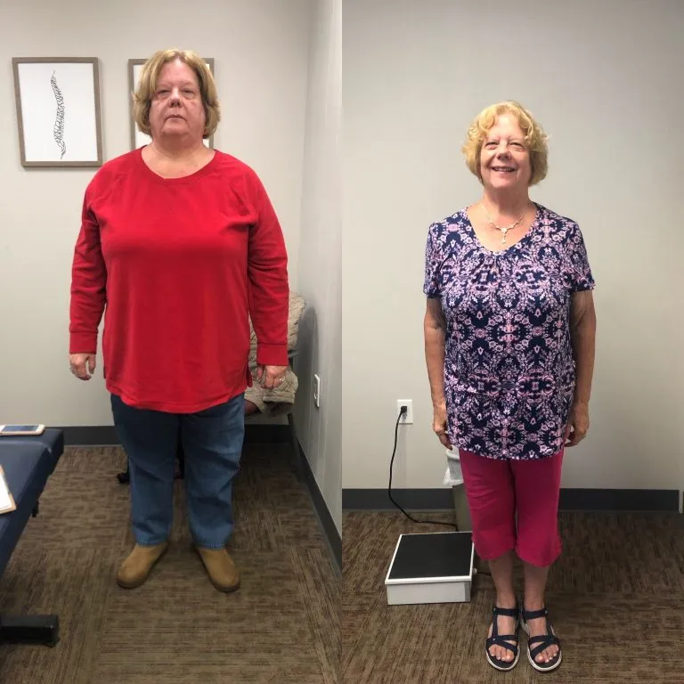Before and after photographs of a weight loss program patient