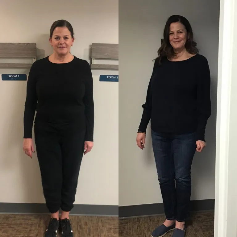Before and after photographs of a weight loss program patient